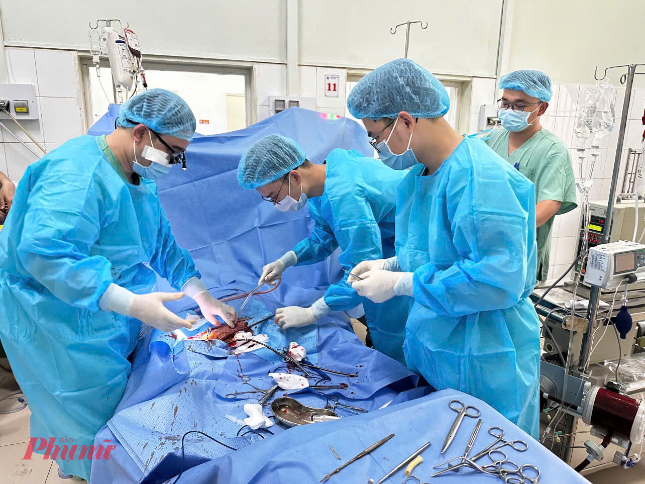 Thời điểm các bác sĩ tiến hành kỹ thuật ECMO cứu sống N.V.T 