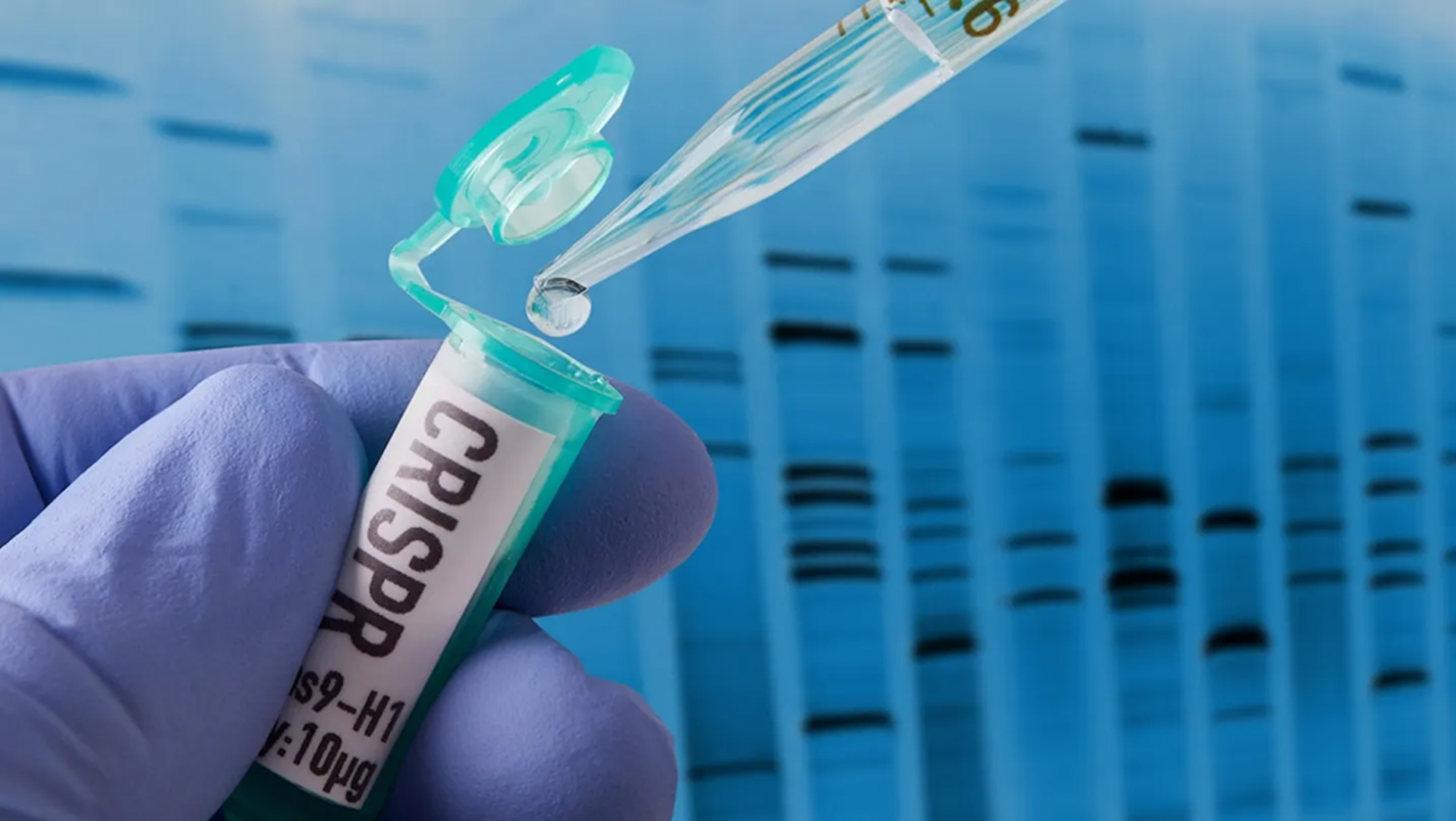 Các nhà khoa học từ bang California sử dụng công nghệ chỉnh sửa gen CRISPR, để “thiết kế” các tế bào miễn dịch có khả năng chữa bệnh Alzheimer — Ảnh: iStock