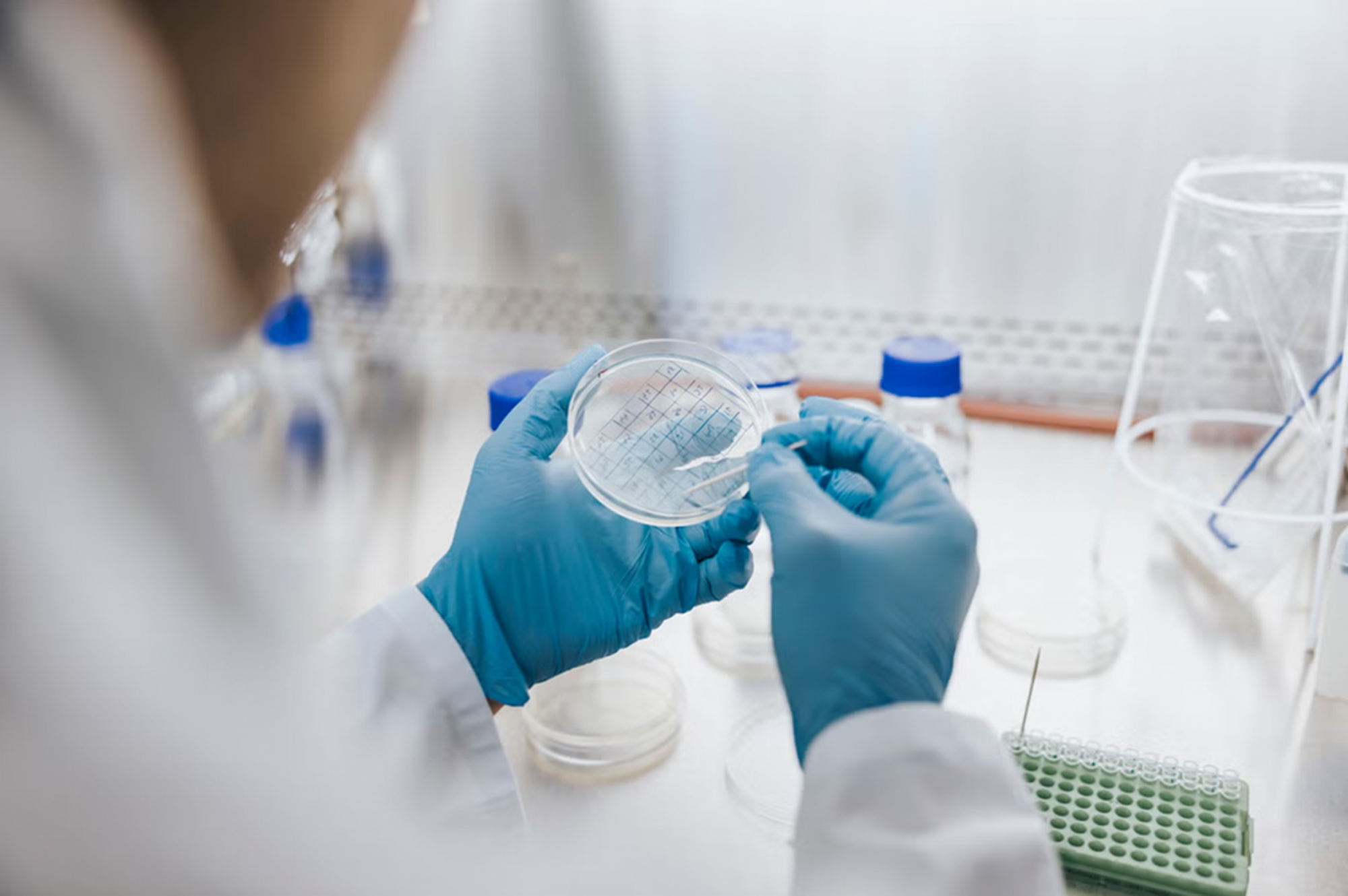Nấm Aspergillus có thể phát triển mạnh ở người vì nó sống sót được ở nhiệt độ ấm — Ảnh: Getty Images