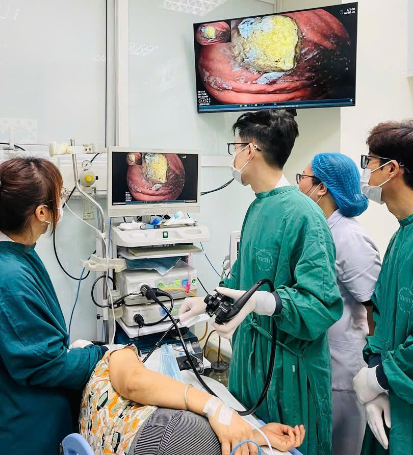 Các bác sĩ can thiệp nội soi lấy khối bã to như quả trứng trong dạ dày của bệnh nhân
