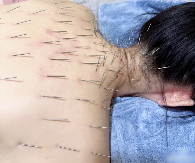 Những phương pháp làm đẹp gây tranh cãi của các ngôi sao