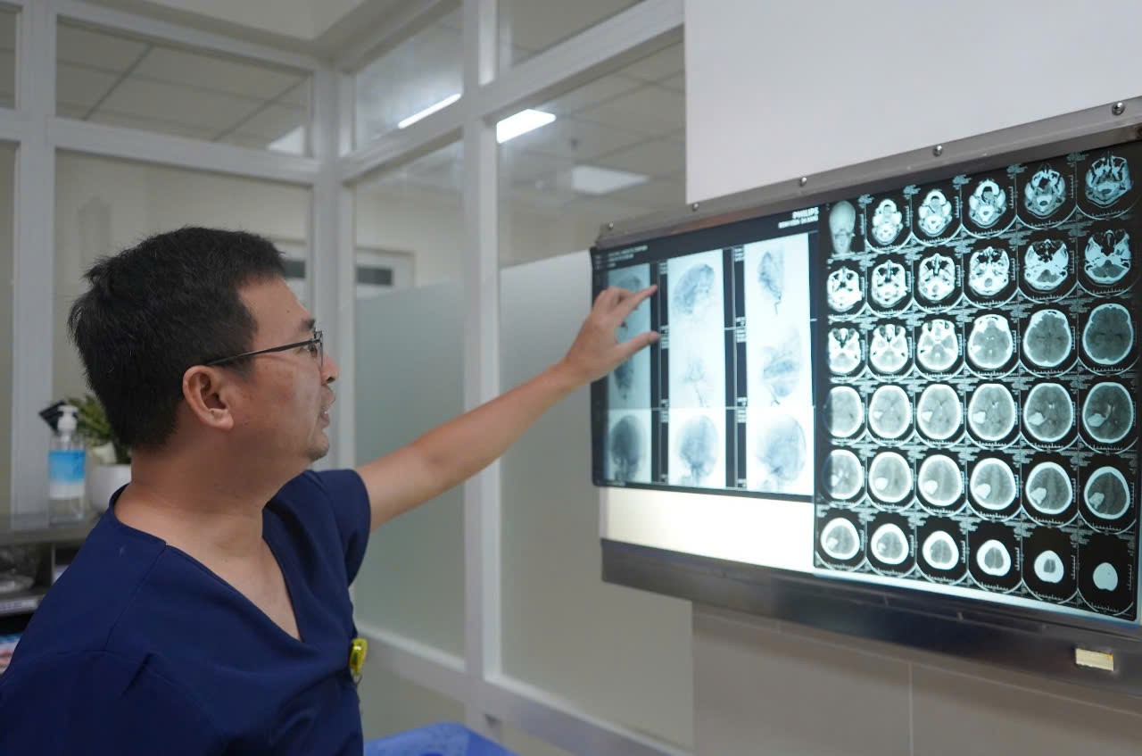 Hình ảnh dị dạng mạch máu não trước phẫu thuật