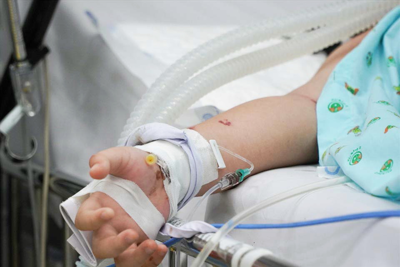 Trẻ sốc sốt xuất huyết đang được điều trị tại Bệnh viện Nhi Đồng 2