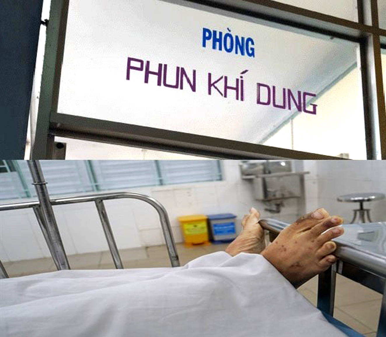 Một bệnh nhi hen suyễn được điều trị ở Bệnh viện Nhi Đồng 1