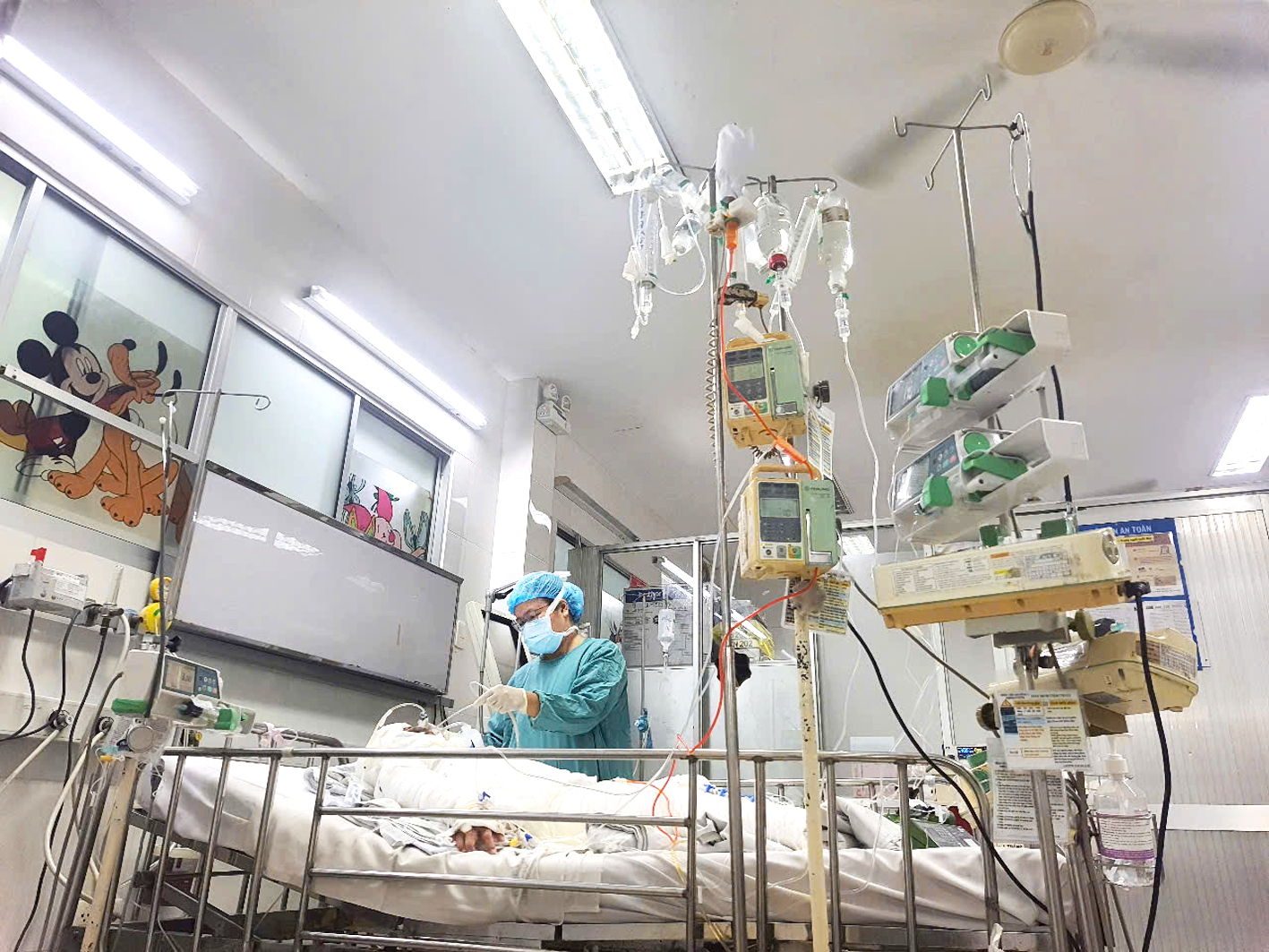 Một bệnh nhi bị phỏng được điều trị ở Bệnh viện Nhi Đồng 1