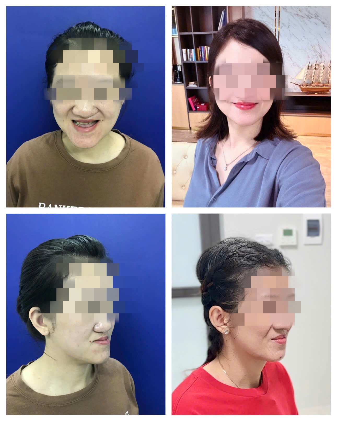 Chị 