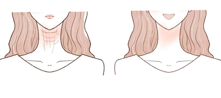 Nhiều người mới chỉ ở độ tuổi 25 đã nhận thấy dấu hiệu lão hóa ở vùng cổ. Da trở nên nhăn nheo, có nếp gấp nhẹ và dần mất đi độ căng. Dù da mặt được chăm sóc kỹ lưỡng thì vùng cổ không đều màu hoặc chảy xệ vẫn làm ngoại hình mất đi sự hài hoà. Khác với da mặt, vùng cổ không thể che giấu bằng trang điểm. Một khi đã xuất hiện nếp nhăn sâu, việc phục hồi sẽ cần thời gian lâu hơn. Do đó việc chăm sóc da cổ cần được thực hiện đồng thời với da mặt ngay khi còn trẻ.