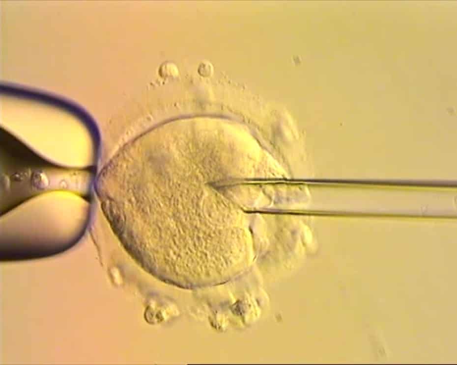 Liệu pháp hiến tặng ty thể tạo ra phôi IVF với DNA từ ba người để ngăn ngừa trẻ em mắc các rối loạn di truyền không thể chữa khỏi - Ảnh: PA