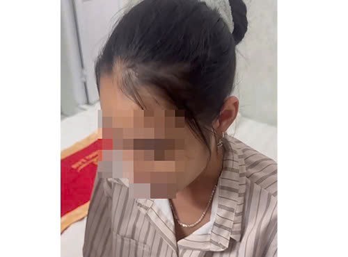 Nữ sinh thời điểm được giải cứu. Ảnh: CACC