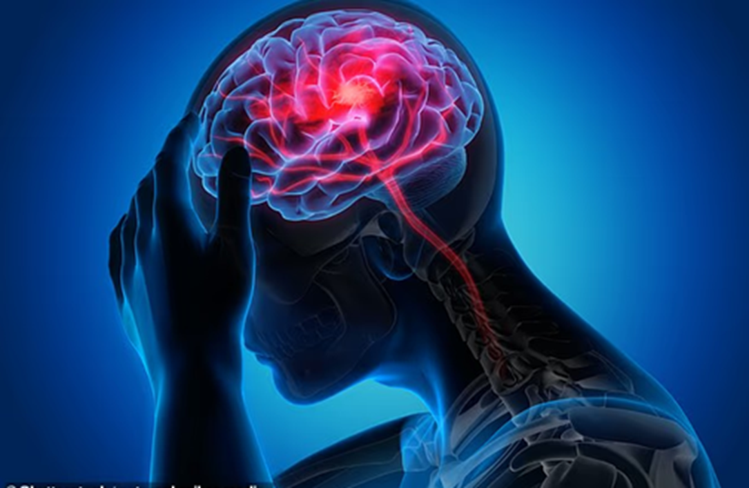 Những phụ nữ bị biến chứng trong thai kỳ có rủi ro bị đột quỵ sớm hơn — Ảnh: Shutterstock