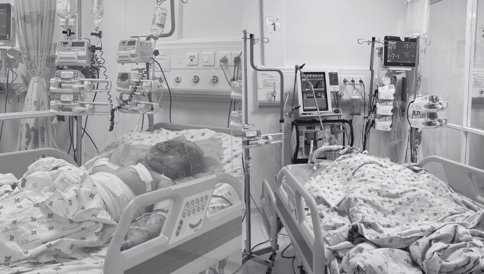 Bé G. và bé L. đang được điều trị tích cực tại Bệnh viện Nhi Đồng Thành phố, ảnh BV
