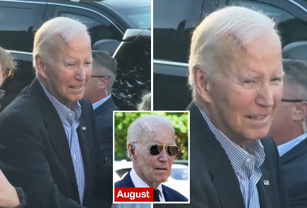 Joe Biden, 82 tuổi, được nhìn thấy với vết thương lớn ở đầu khi sự xuất hiện của cựu tổng thống làm dấy lên lo ngại