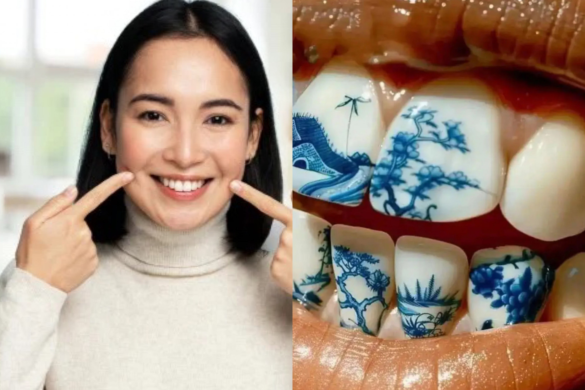 Trong khi nhiều người coi đây là cách thể hiện cá tính, các chuyên gia lại lo ngại về những rủi ro tiềm ẩn với sức khỏe răng miệng. - Ảnh: handout
