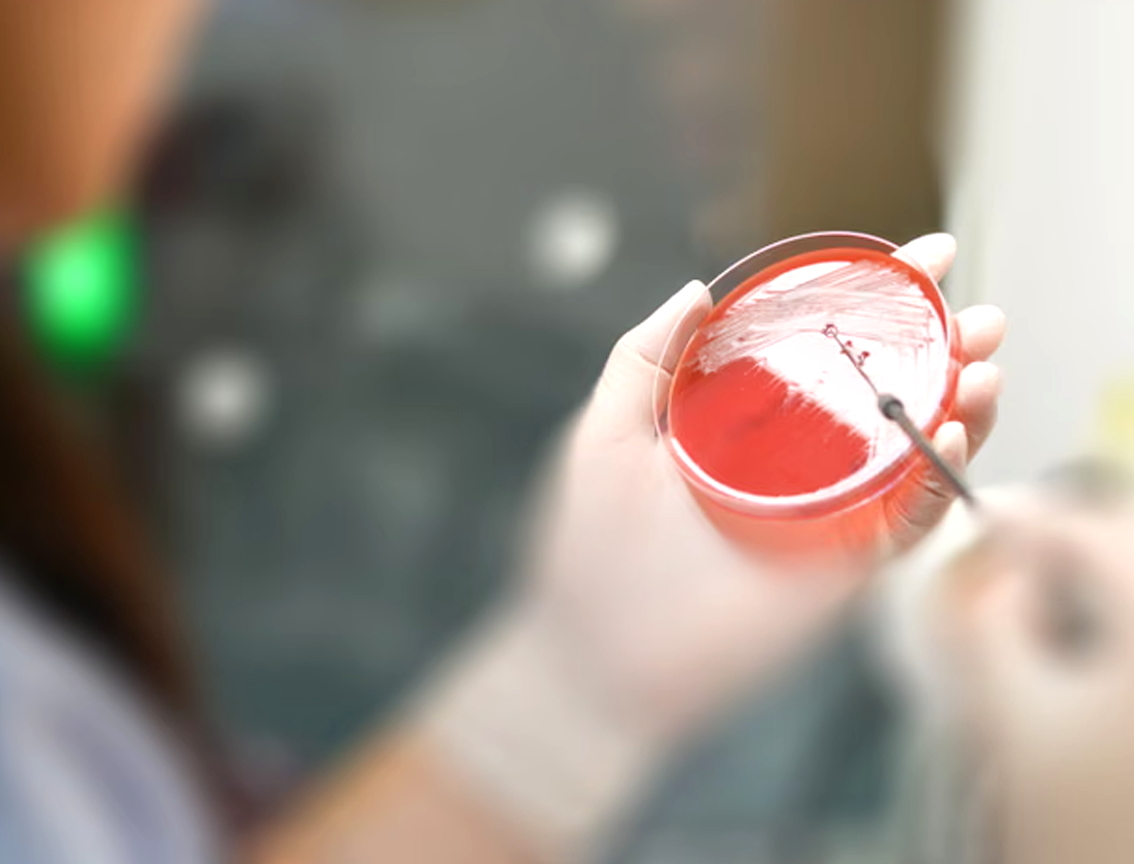 WHO đã lên tiếng báo động về thực trạng nhiễm khuẩn kháng thuốc đang tăng mạnh - Nguồn ảnh: Getty Images