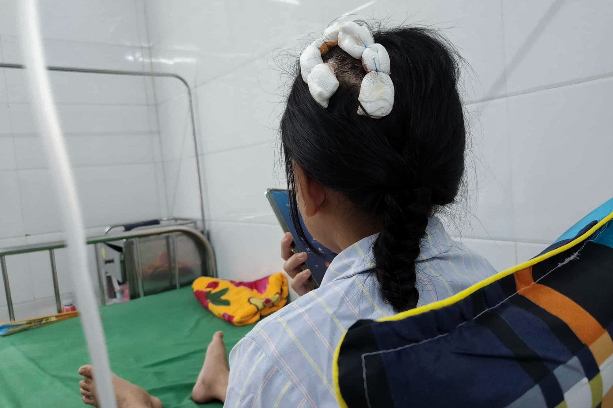 Bé L. phải khâu nhiều mũi trên đầu do bị cha dượng đánh bằng búa đinh - Ảnh: Khánh Trung