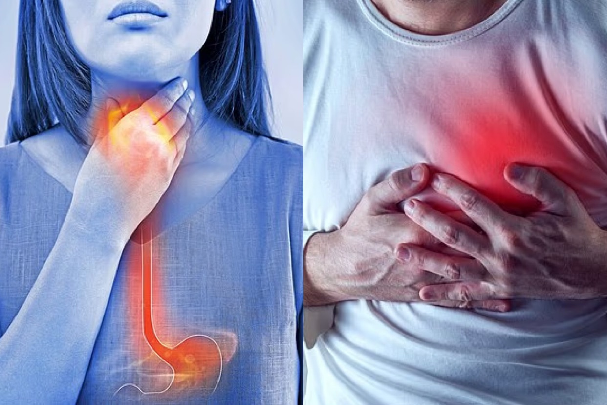 Tại Anh, hơn 20% dân số được ước tính sẽ gặp tình trạng này ít nhất một lần trong đời, trong đó khoảng 1,5 triệu người cần điều trị lâu dài bằng thuốc.. Ảnh minh họa: istock