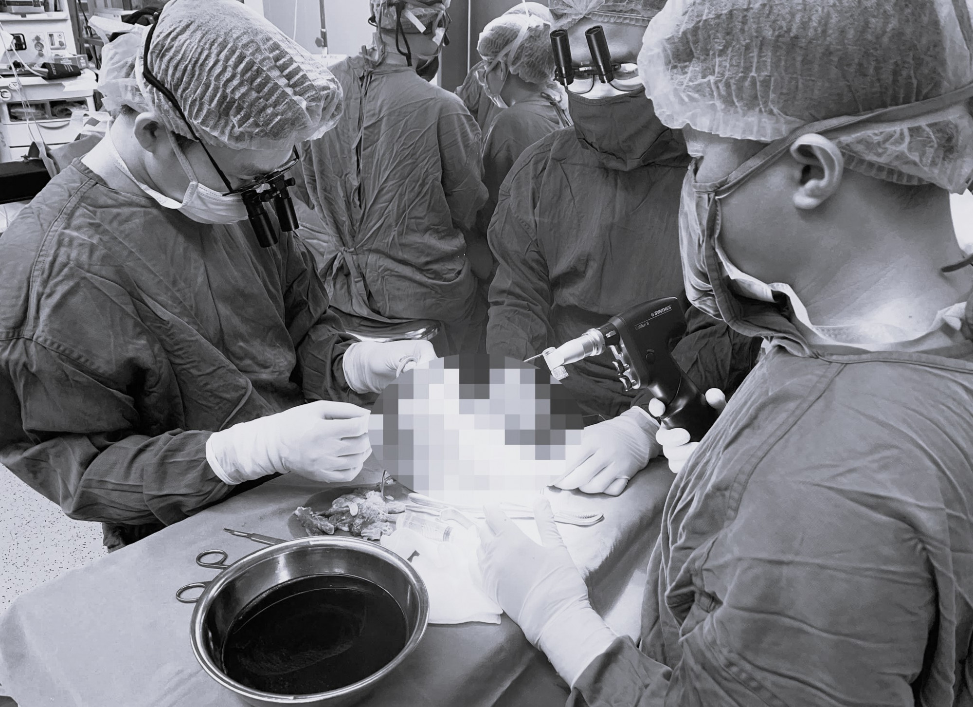 Các bác sĩ phẫu thuật nối phần chân đứt lìa của nữ sinh sau vụ tai nạn - ảnh: bệnh viện cung cấp