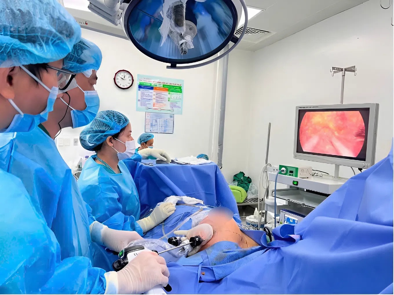 Ê-kíp bác sĩ mổ nội soi tuyến vú cho người bệnh, ảnh BVCC