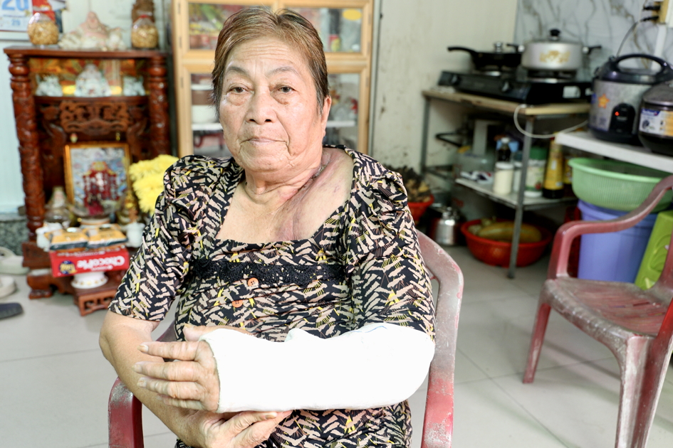 Nhiều năm qua, bà Huỳnh Thị Gàng vẫn bền bỉ chống chọi với căn bệnh ung thư quái ác, một mình vượt qua những chặng đường gian nan để níu giữ sự sống