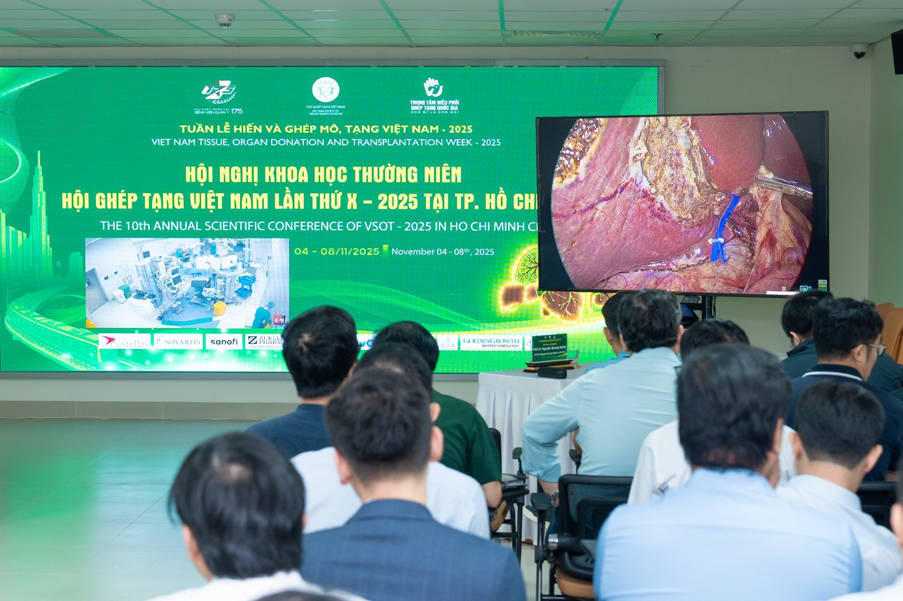 Ca mổ được truyền hình trực tiếp tới hội trường hội nghị, thu hút sự chú ý của các chuyên gia trong và ngoài nước - Ảnh: Vinmec