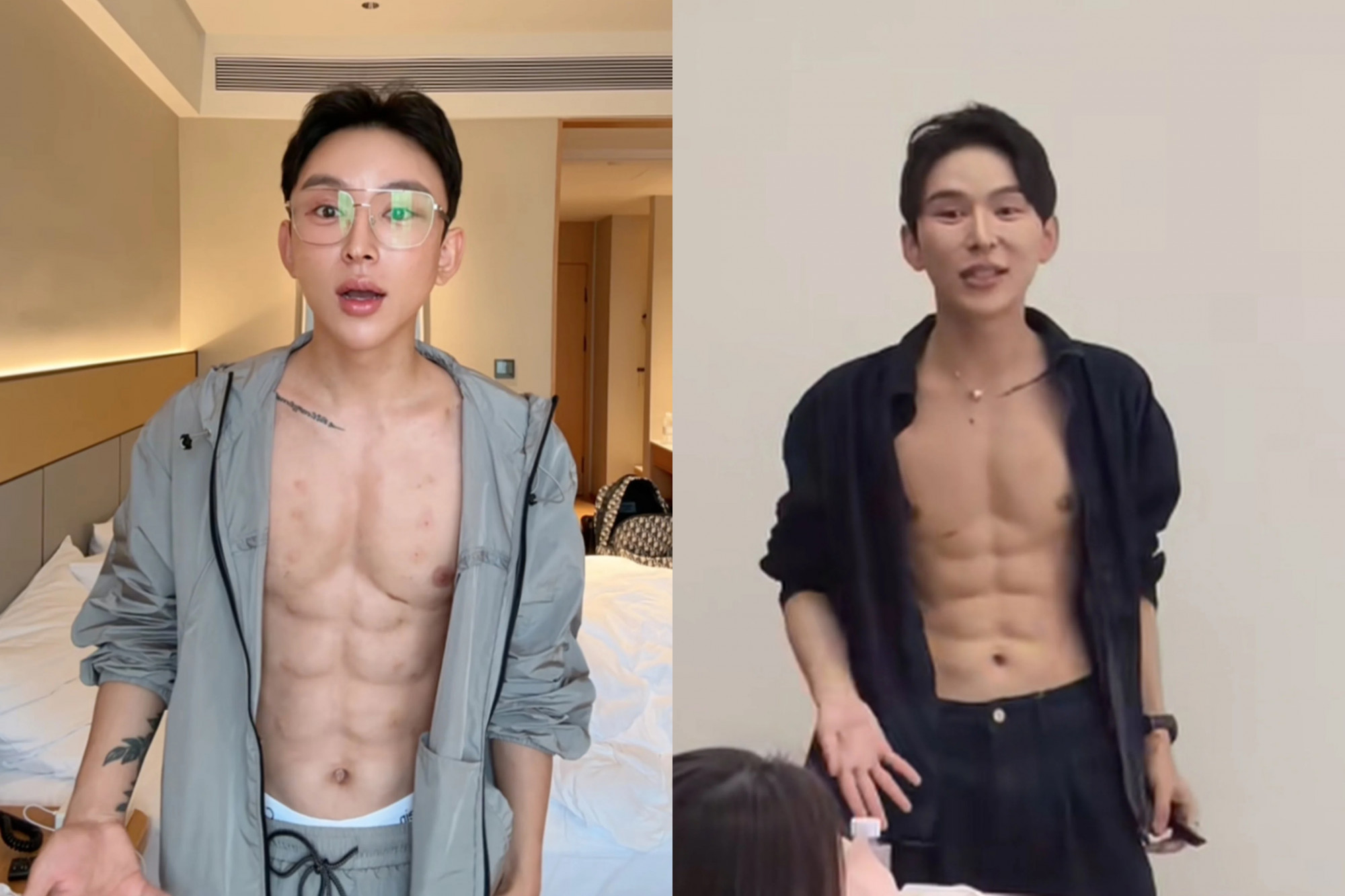 Vì không hài lòng với cơ bắp hiện tại, Hao quyết định chi hơn 14 tỷ đồng tiêm axit hyaluronic để tạo hình cơ bụng 8 múi. -Ảnh: