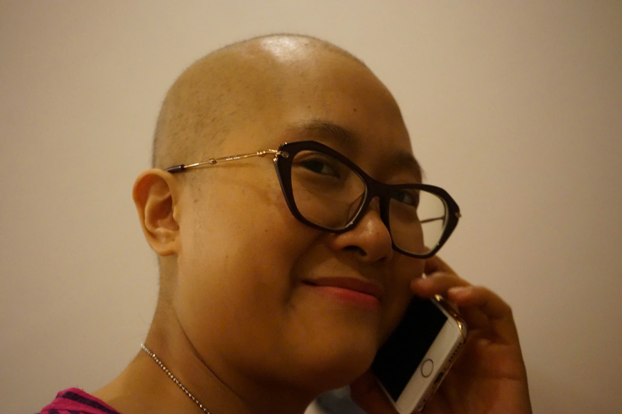 Chị Hương những năm điều trị đầu tiên, tóc rụng hết, chân tay bị bóc da đau đớn (Ảnh: NVCC)