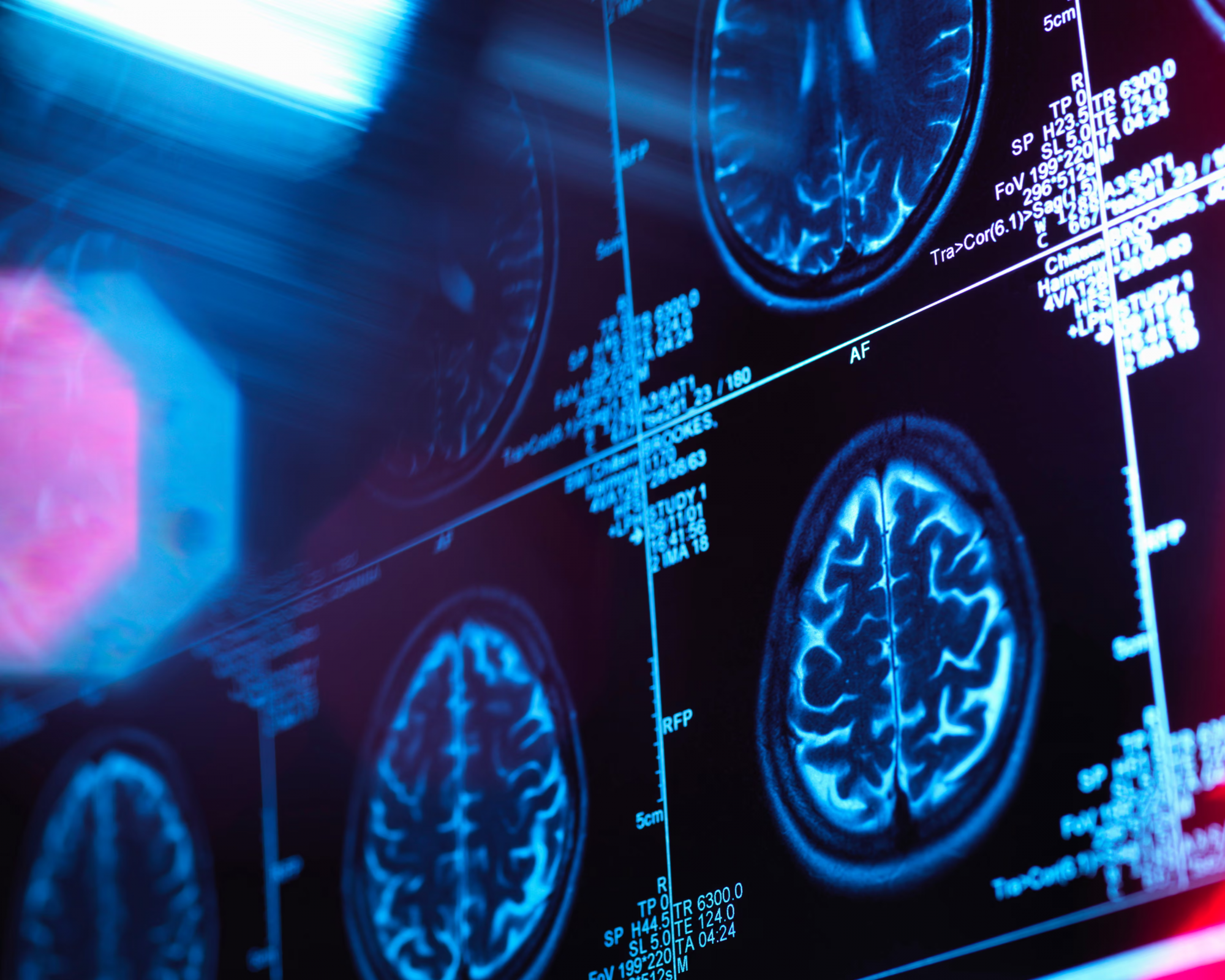 Theo nghiên cứu mới về não bộ, con người chỉ thực sự trưởng thành sau 32 tuổi — Ảnh: Getty Images 