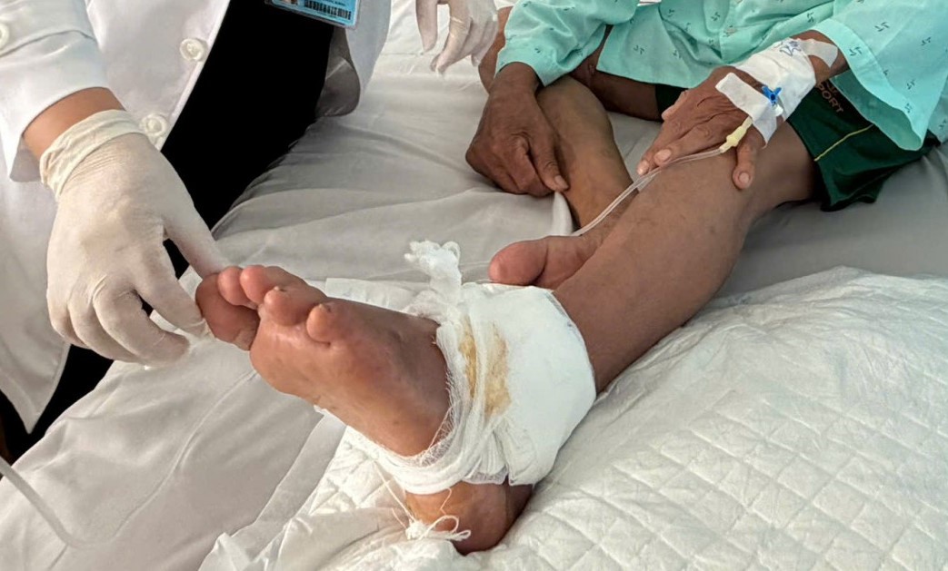 Một bệnh nhân bị nhiễm trùng nghiêm trọng do tiếp xúc nước dơ - Ảnh: Thanh Huyền