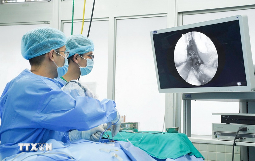 Bác sỹ Bệnh viện Chợ Rẫy thực hiện phẫu thuật lấy khối u tuyến yên khổng lồ cho bệnh nhân bằng Hệ thống phẫu thuật nội soi thần kinh hiện đại. (Ảnh: TTXVN 