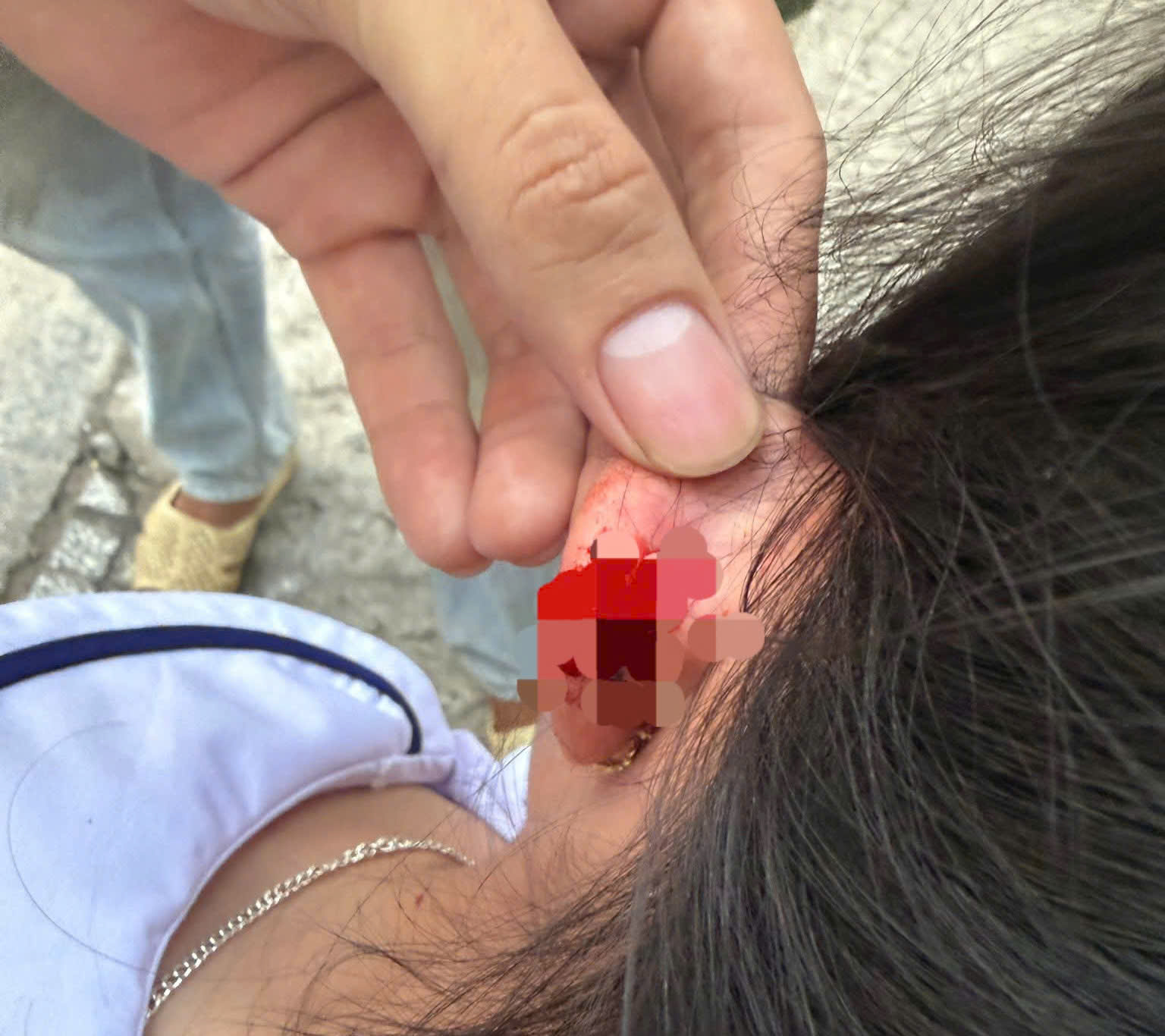 Cháu T.T.K. bị chảy máu tai khi bị giáo viên chủ nhiệm nhéo do viết bài sai - Ảnh MXH