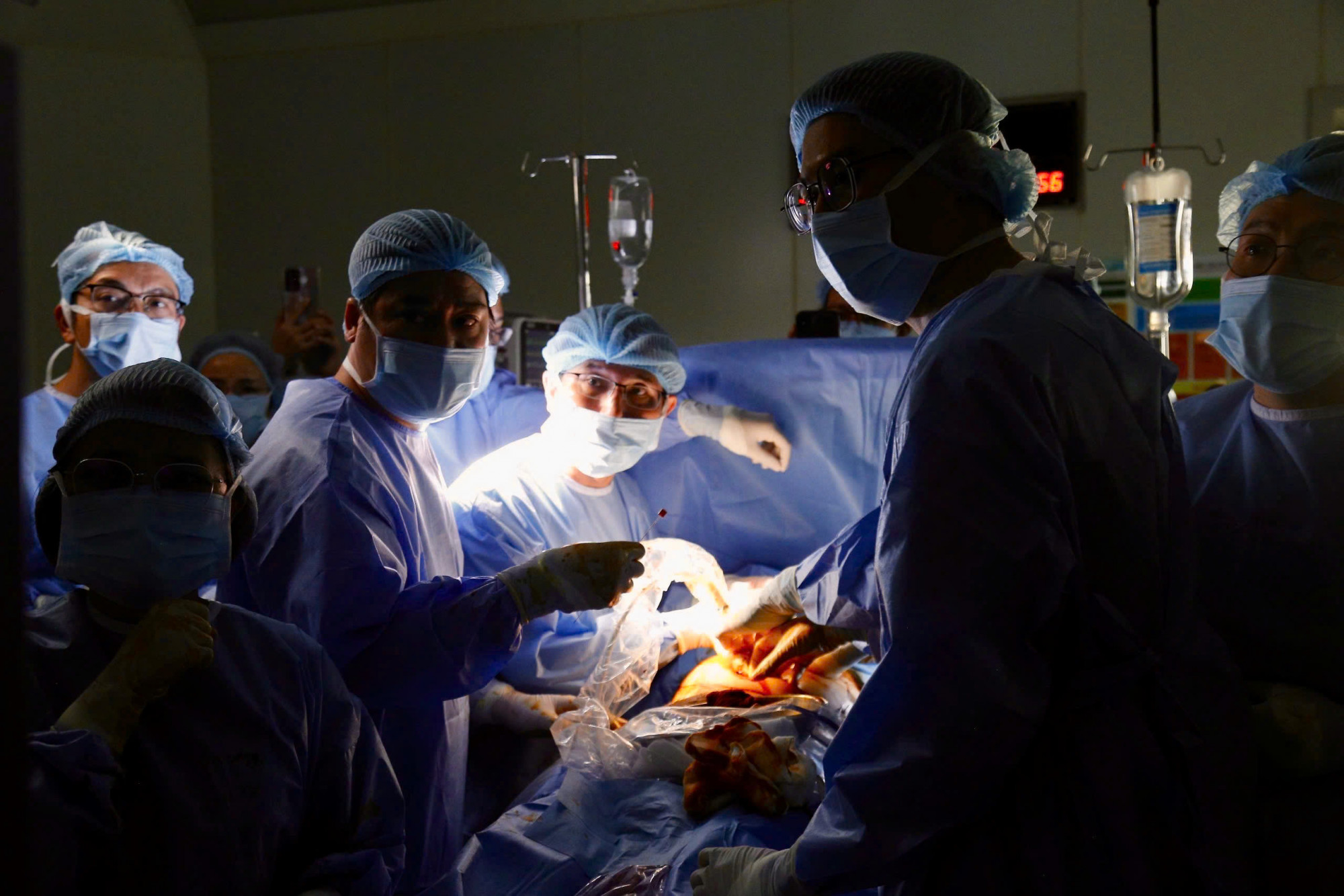 Ê-kíp bác sĩ thực hiện can thiệp thông tim bào thai cho người bệnh, ảnh BVCC