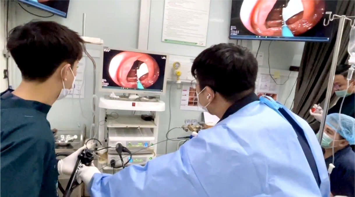 Bác sĩ nội soi phát hiện sán dây trong đại tràng bệnh nhân - ảnh: T.S.