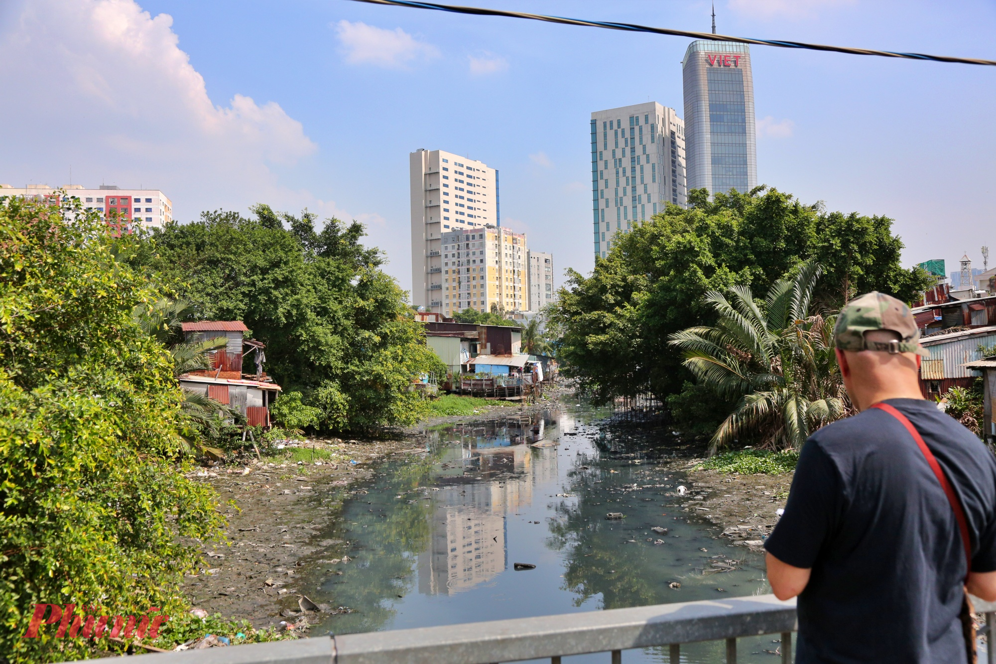 Tổng vốn đầu tư của dự án hơn 17.200 tỉ đồng, trong đó chi phí bồi thường, hỗ trợ và tái định cư chiếm phần lớn. Riêng tại quận Bình Thạnh trước đây, trong tổng số 2.078 hộ dân thuộc diện thu hồi đất, có 314 hộ ở phường Bình Lợi Trung, 872 hộ ở phường Gia Định và 892 hộ ở phường Bình Thạnh.