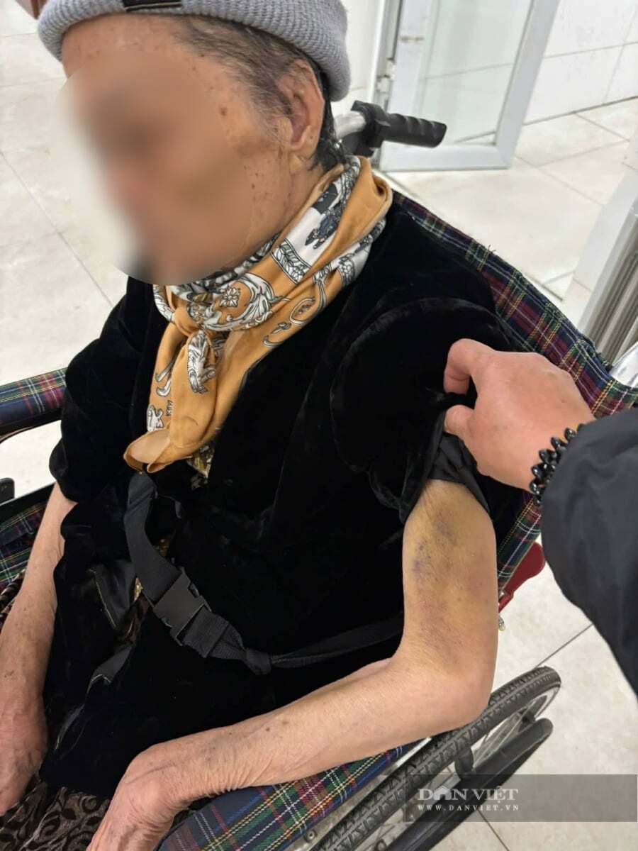 Từ vụ người giúp việc bạo hành cụ 82 tuổi ở Hà Nội: Đừng phó mặc cha mẹ cho người giúp việc rồi ân hận Cụ bà bị đánh đập mỗi ngày, người đầy bầm dập và tinh thần hoảng loạn