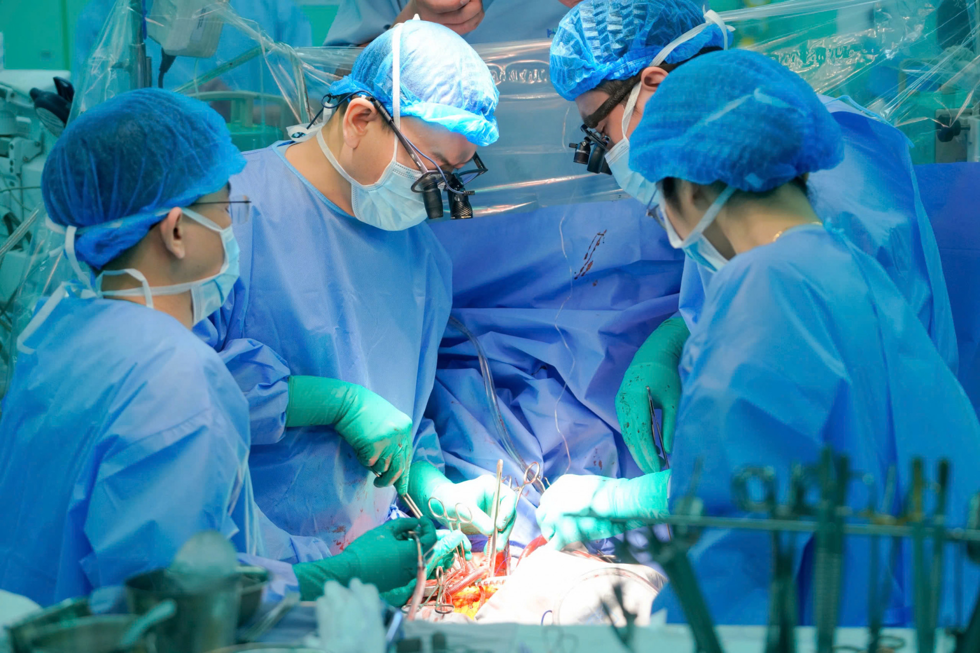 Các bác sĩ phẫu thuật lấy tạng ghép - ảnh: Bệnh viện cung cấp