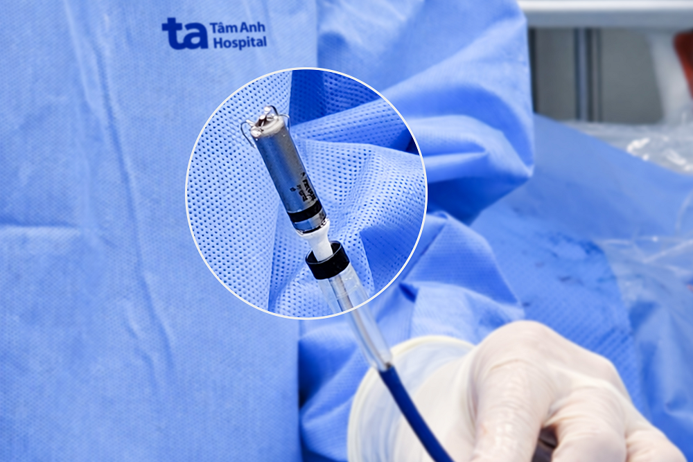 Cận cảnh máy tạo nhịp không dây thế hệ mới Micra AV2 - Ảnh: BVĐK Tâm Anh