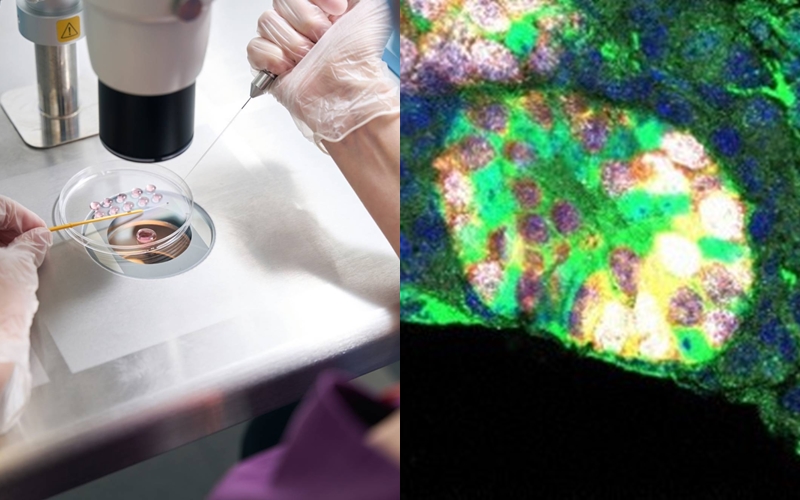 ột tế bào chuột được tạo ra nhân tạo, có hình dạng giống tế bào gốc sinh tinh (màu trắng) – tức tế bào tiền thân của tinh trùng.