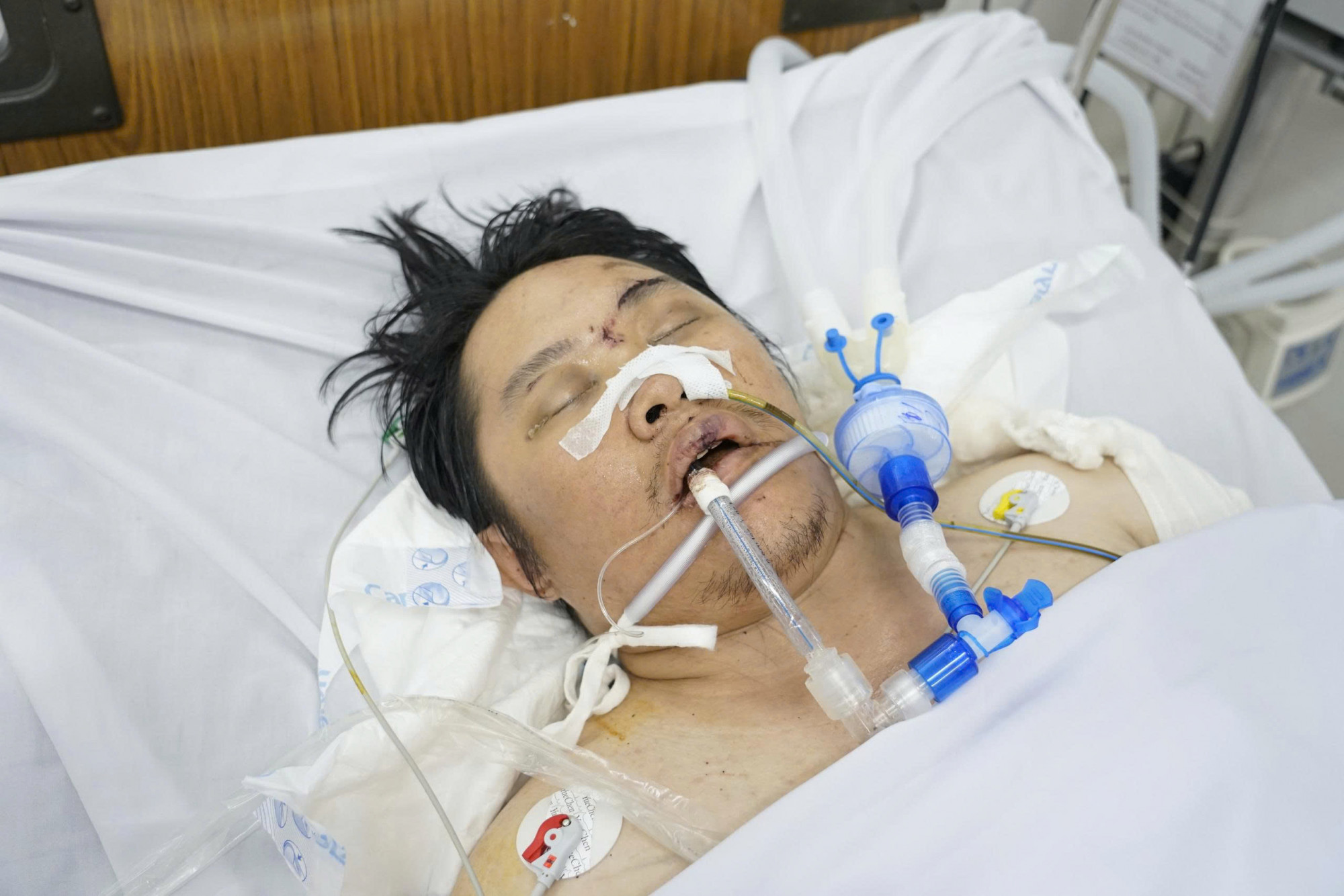 Bệnh viện đang tìm người thân cho người đàn ông khoảng 30 tuổi bị tai nạn giao thông đang được điều trị tại Bệnh viện Nhân dân Gia Định cơ sở 2, ảnh BVCC