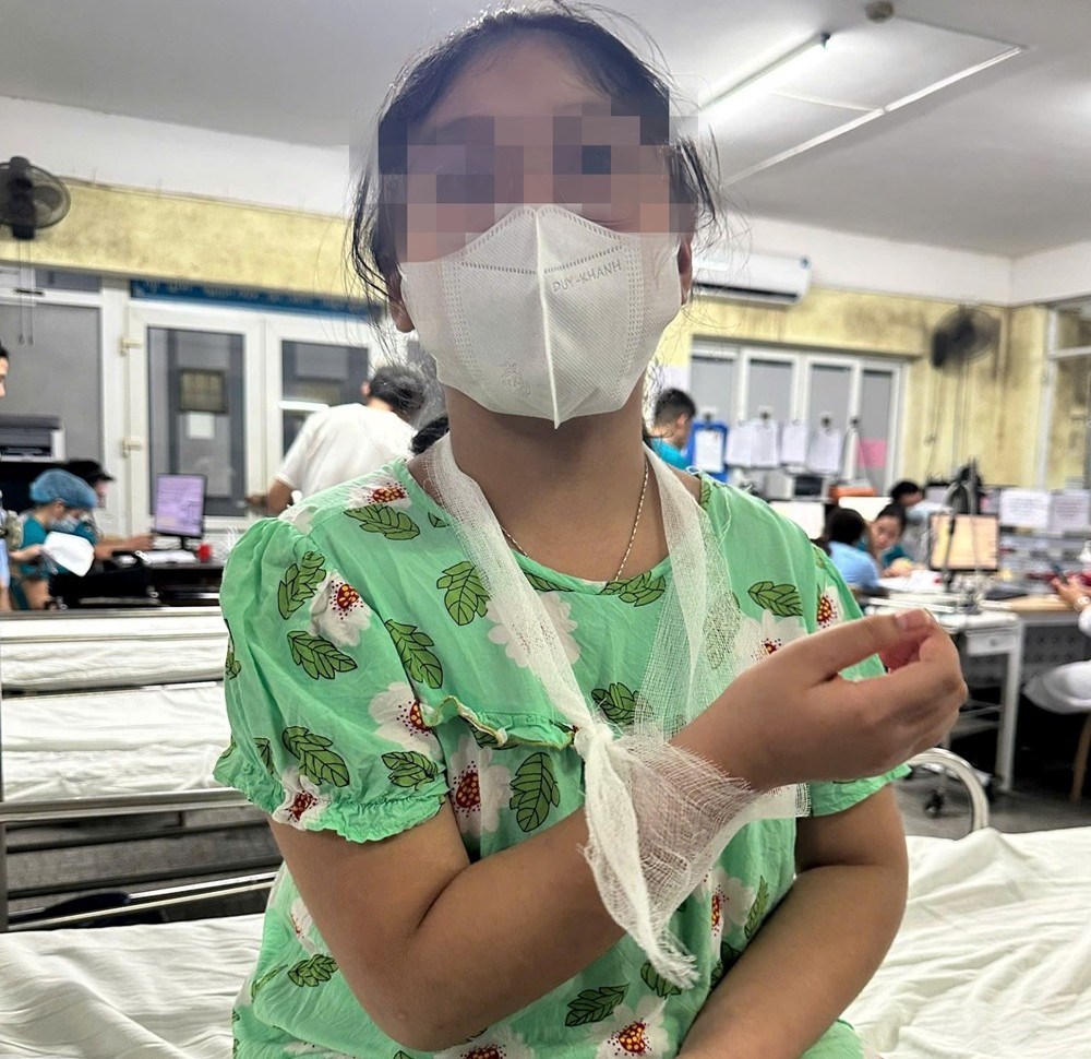 Cháu T.L.A.T  thời điểm vào nhập viện tại Bệnh viện Trường Đại học Y Dược Huế