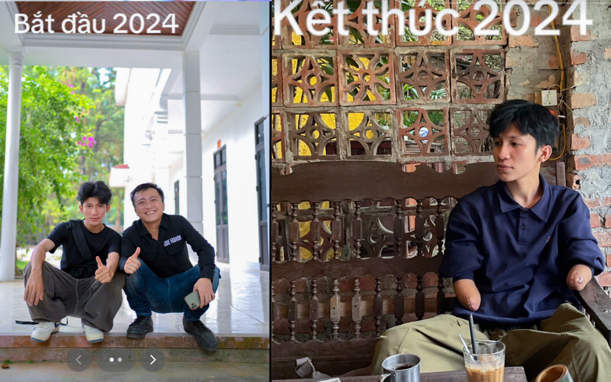 Hình ảnh so sánh trước và sau tai nạn được Định chia sẻ lên mạng xã hội - Ảnh chụp màn hình