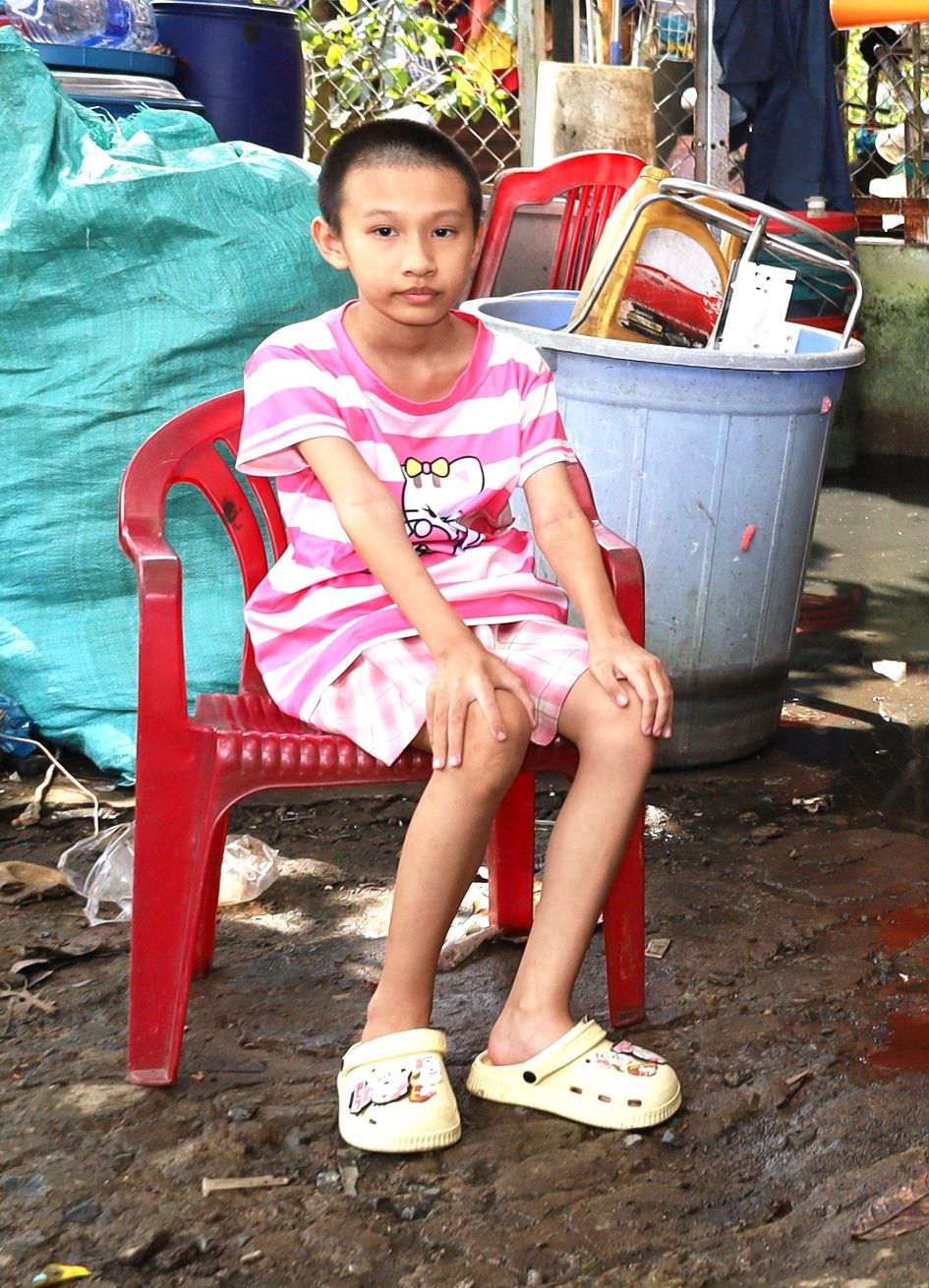 Bé Phạm Kim Thy đang bị khối u ác tính... Ảnh: CTV