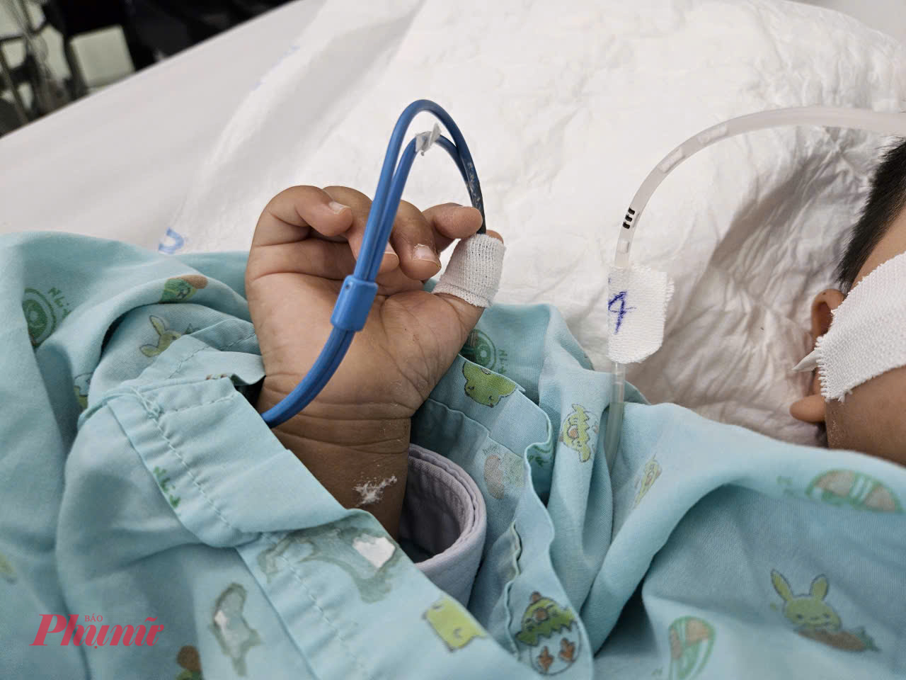 Ngoài ra, phụ huynh cần phát hiện được dấu hiệu bệnh như sốt cao, lừ đừ, mệt mỏi, trẻ hay chảy nước bọt, sợ ăn vì có vết loét trong miệng, nôn ói, run tay chân… nên đưa trẻ đến cơ sở y tế kịp thời.