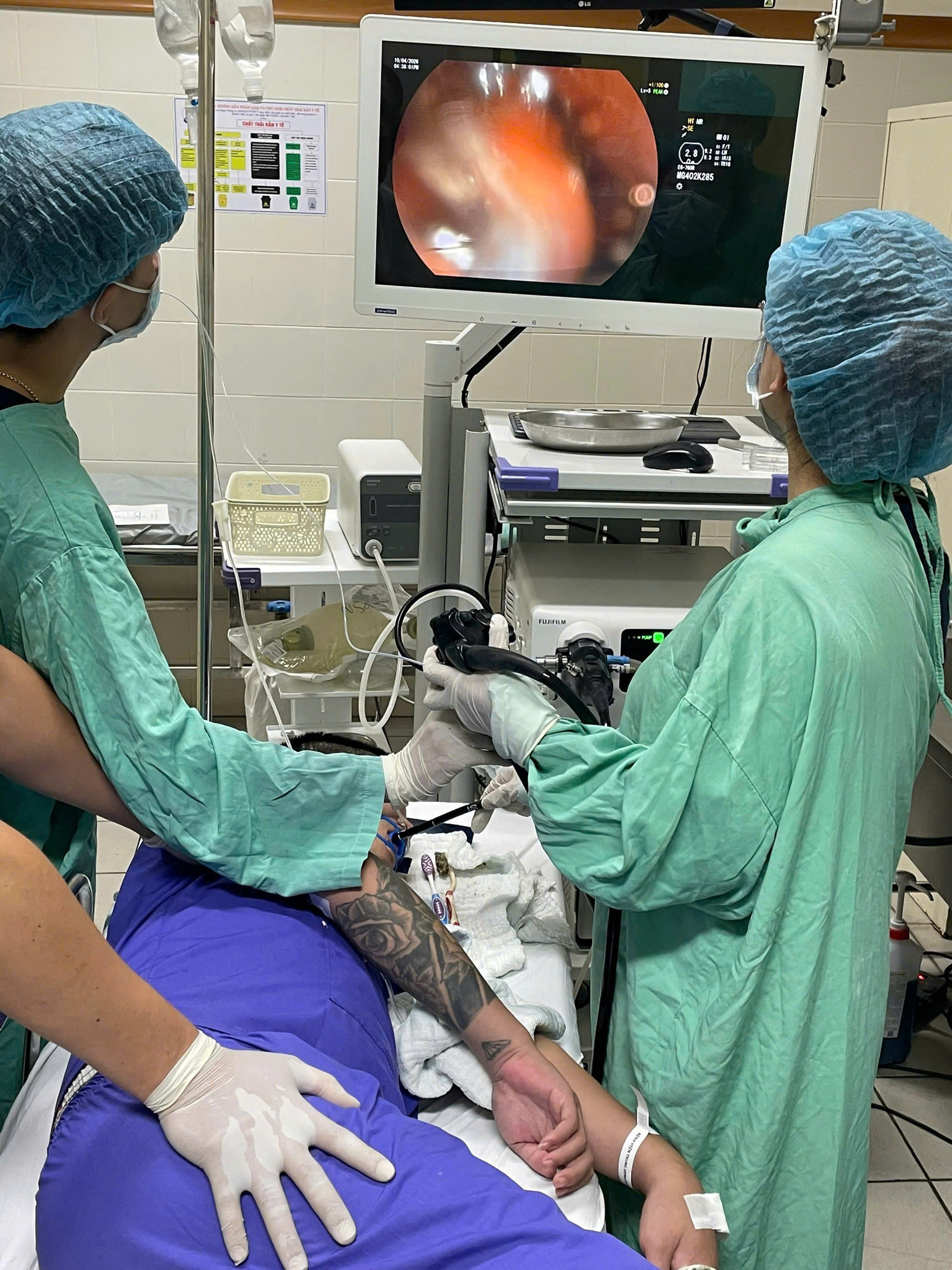 Đội ngũ y bác sĩ nhanh chóng tiến hành phương pháp nội soi và không cần can thiệp phẫu thuật để gắp dị vật 