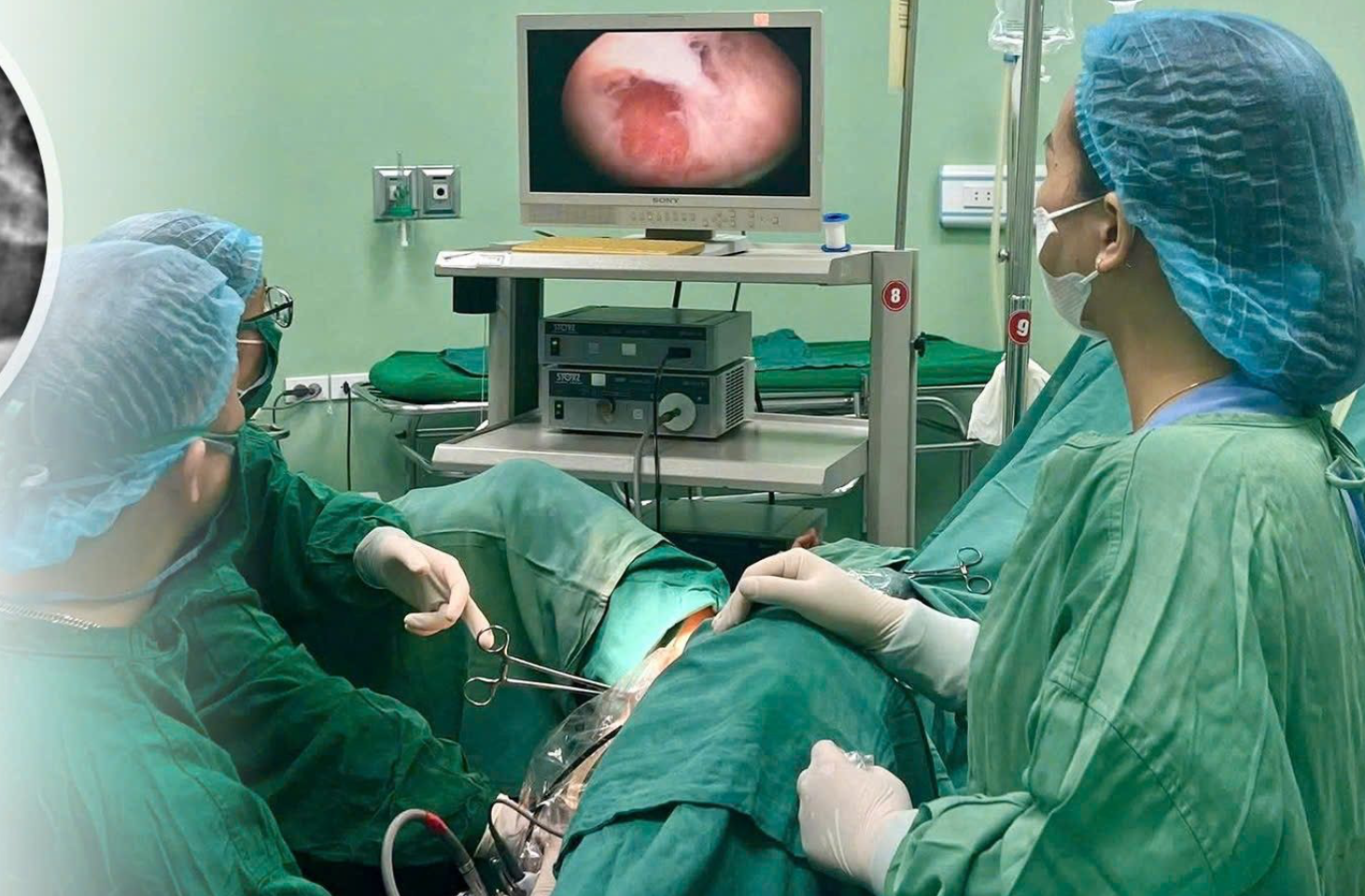 2 tháng sau ca phẫu thuật, kinh nguyệt của người phụ nữ 26 tuổi này đã trở lại đều đặn như trước - Ảnh: H.Yến