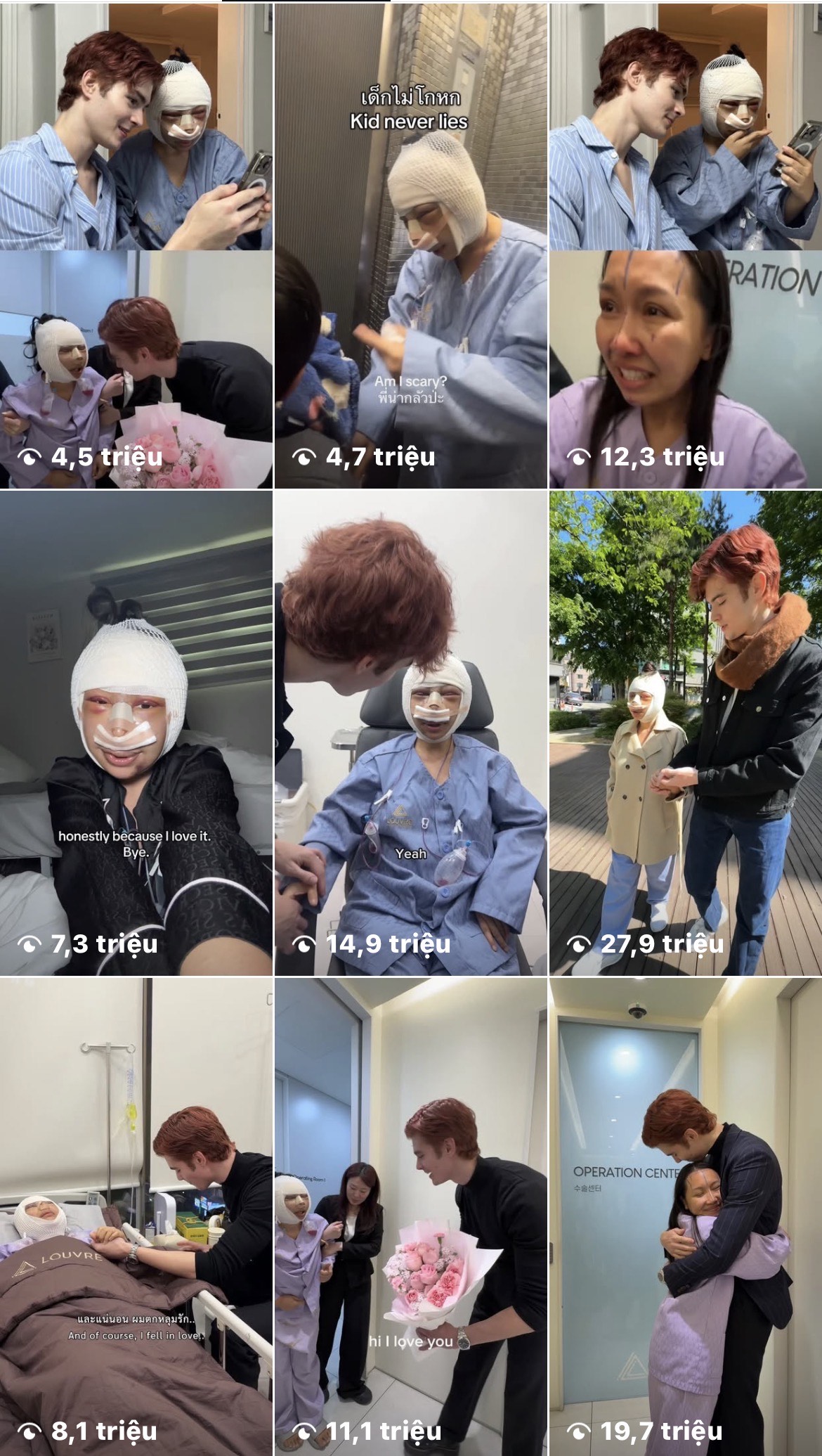 Pugun chia sẻ hành trình phẫu thuật thẩm mỹ nhận được hàng triệu lượt xem - Ảnh: Instagram nhân vật