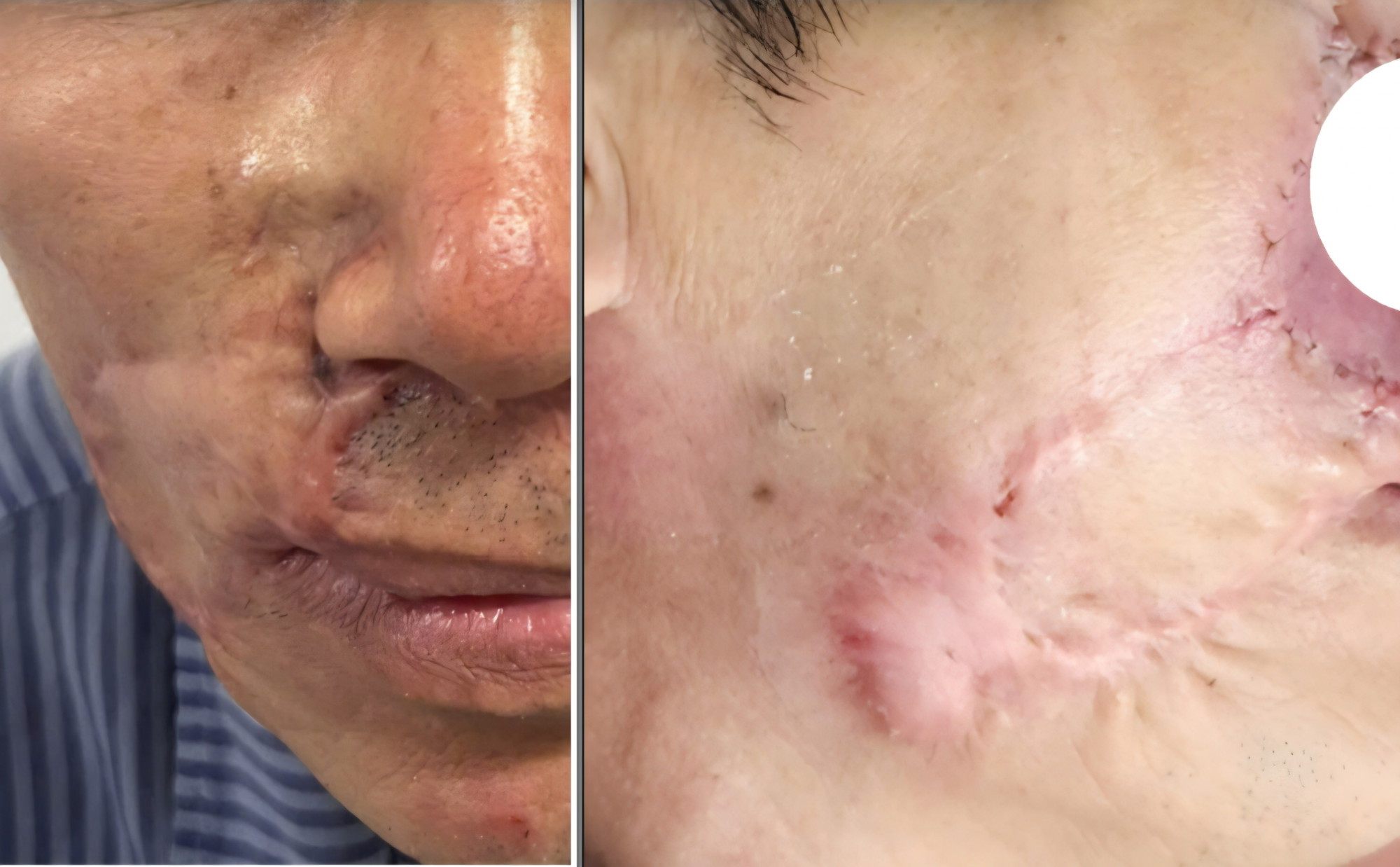 Hình ảnh bệnh nhân trước (trái) và sau điều trị (phải) - ảnh: Bệnh viện cung cấp