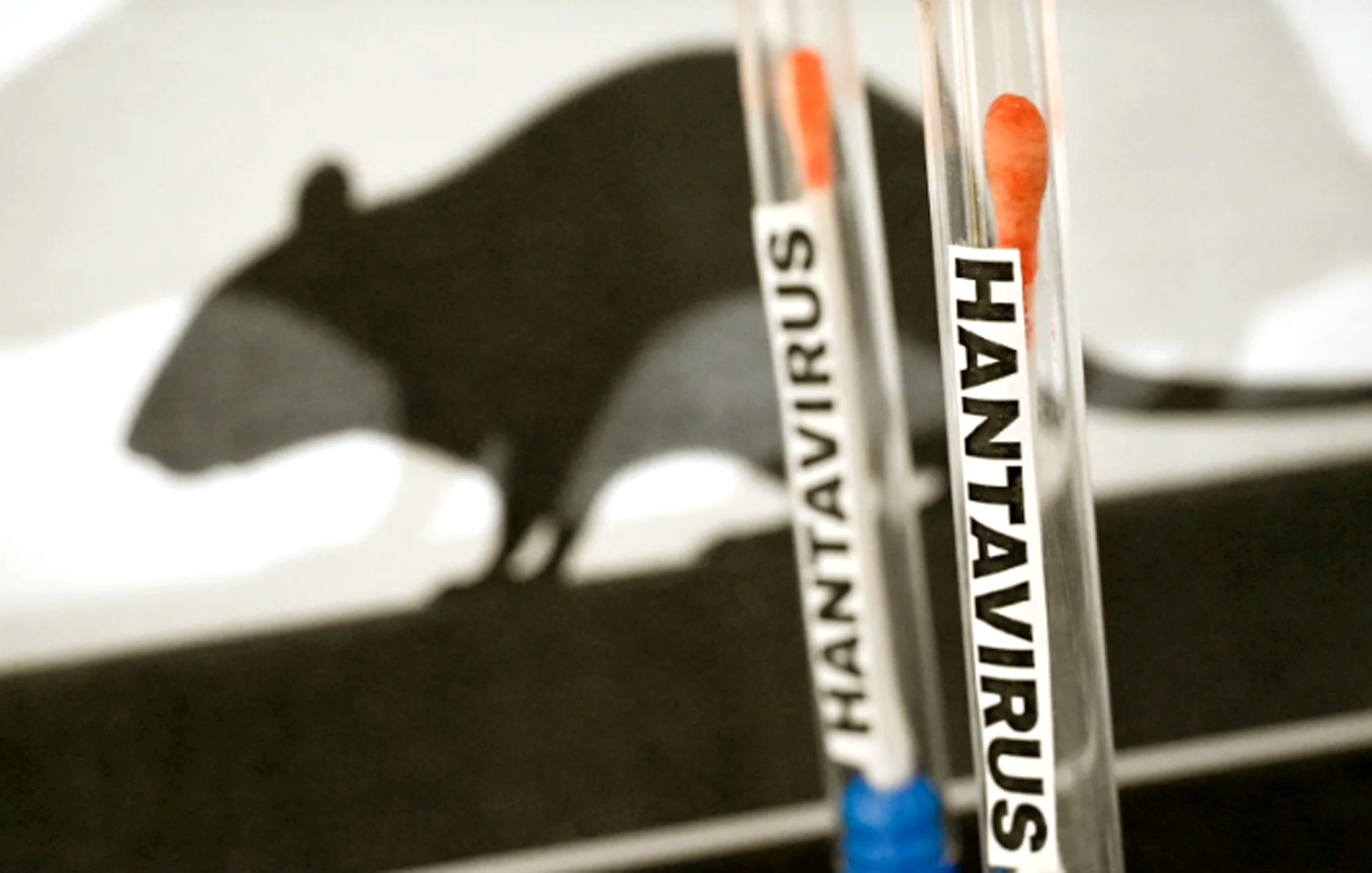 Bộ xét nghiệm hantavirus được chụp ở Paris vào ngày 4/5 - Nguồn ảnh: Getty Images