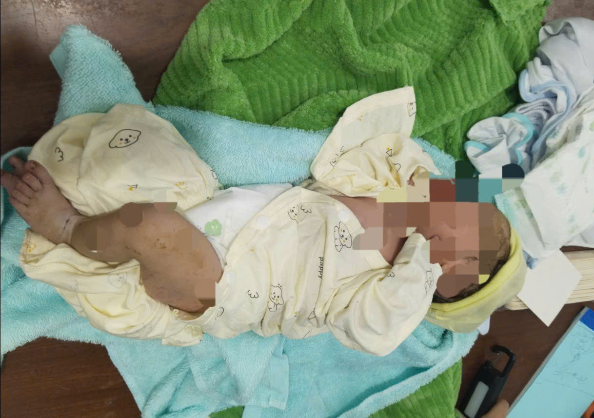 Bé gái bị bỏ rơi tại khu phố 3 An Thới, đặc khu Phú Quốc - Ảnh đặc khu cung cấp
