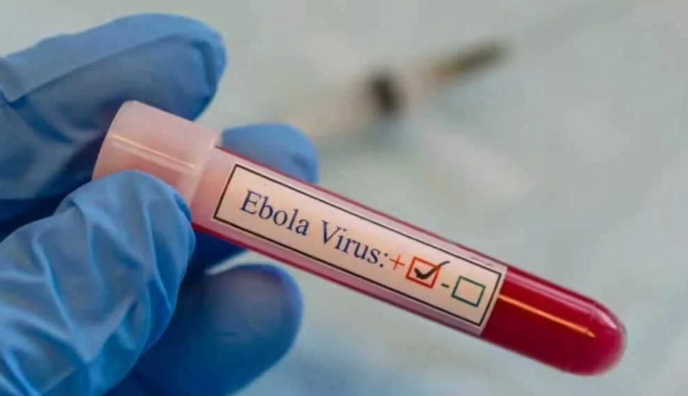 Vi rút Ebola - Ảnh: TH
