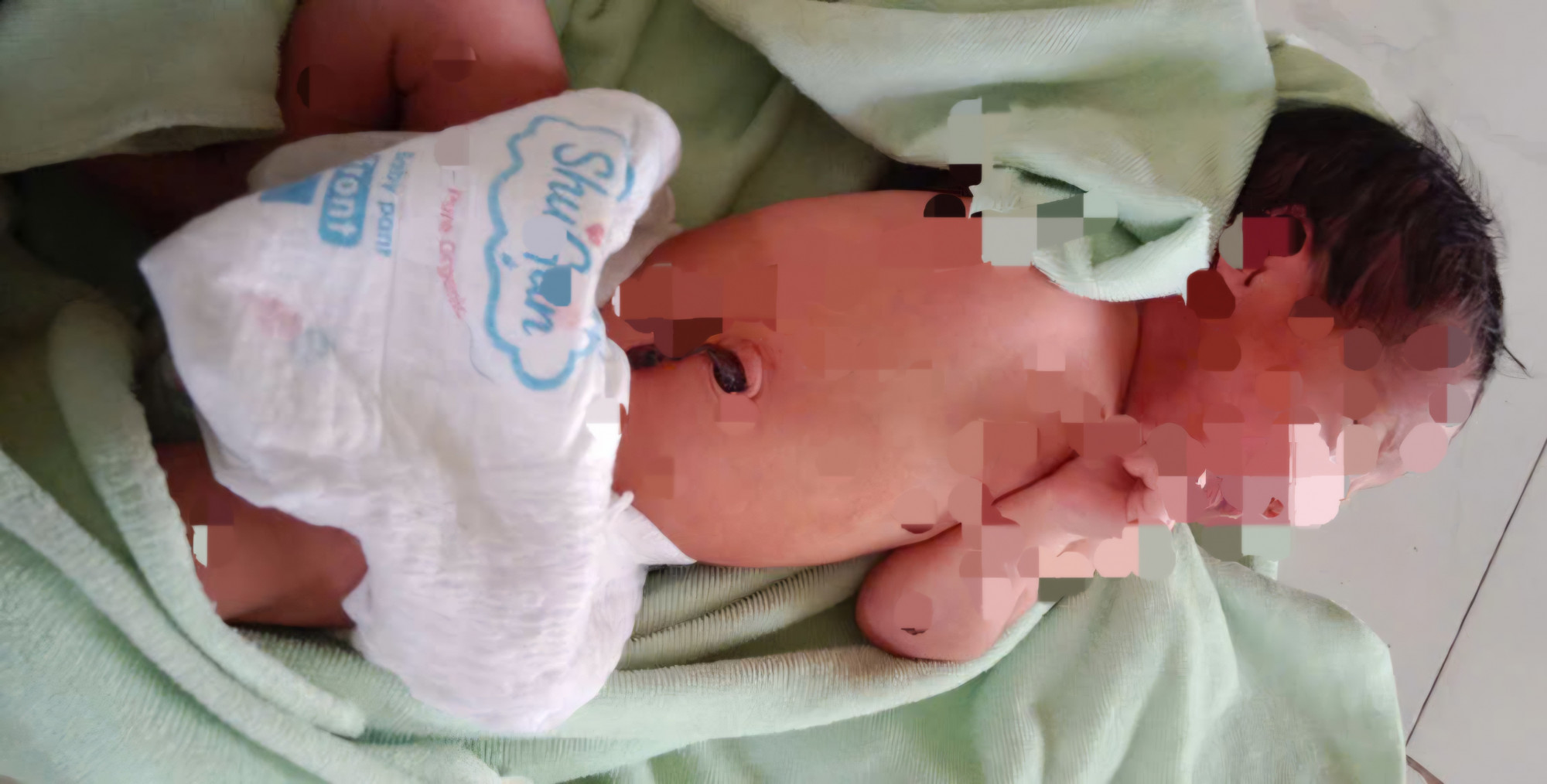 Bé gái vừa được người dân phát hiện bị bỏ rơi tại khu phố Búng Gội Cửa Dương, đặc khu Phú Quốc - Ảnh CTV